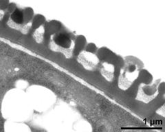 pollen wall, interapertural area, primexine matrix, pollenkitt