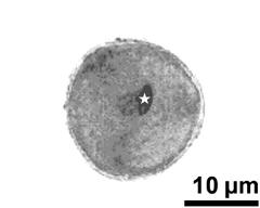 pollen grain with generative cell (asterisk) and vegetative nucleus