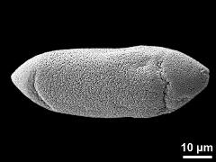 dry pollen grain (polar proximal view with 2 additional "apertures")