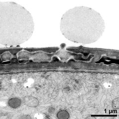 interapertural area of pollen wall