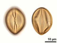 acetolyzed pollen,equatorial view