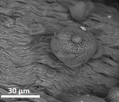 dry pollen,equatorial view