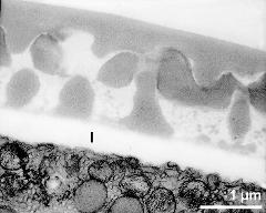 interapertural area of pollen wall