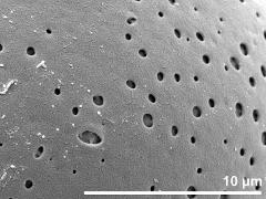 exine surface