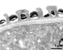 pollen wall; interapertural area