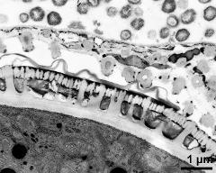 pollen wall in interapertural area, Ubisch bodies on loculus wall