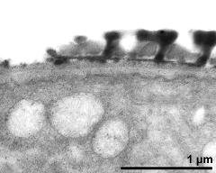 pollen wall at transition of aperture and interapertural area