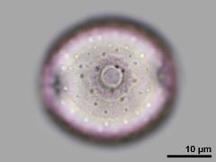 equatorial view,hydrated pollen