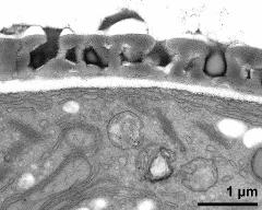 interapertural area of pollen wall