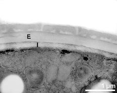 interapertural area of pollen wall