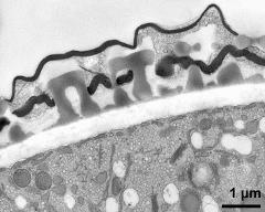 pollen wall; interapertural area