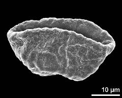 dry pollen grain in equatorial view