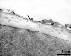 pollen wall at transition of aperture and interapertural area