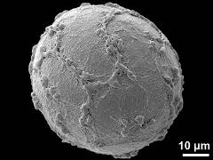 distal polar view