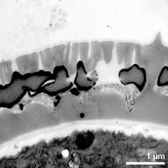 interapertural area of pollen wall