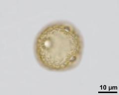 acetolysed pollen, upper focus