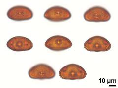 acetolyzed pollen,equatorial view