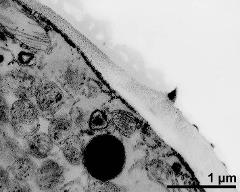 pollen wall at transition of aperture and interapertural area