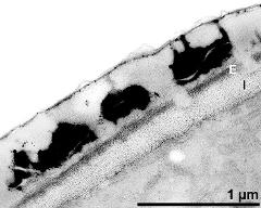 interapertural area of pollen wall, intine (I), endexine (E)