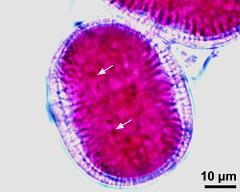 pollen grain with sperm cells (arrows)