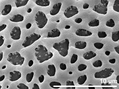 exine surface