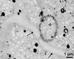 generative cell (asterisk) and vegetative nucleus (arrows)