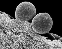 pollen grains with Ubisch bodies