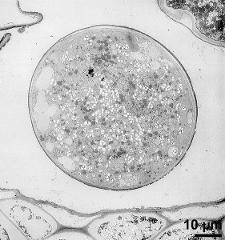 pollen grain in cross section