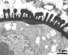 pollen wall, aperture area