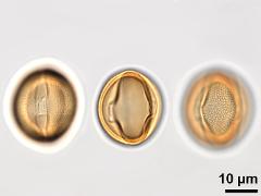 acetolyzed pollen,equatorial view