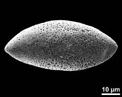 dry pollen grain in polar view (proximal)