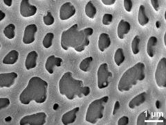 exine surface