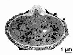 pollen grain with vegetative nucleus (asterisk) and sperm cells