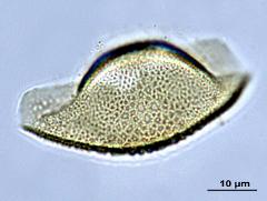 acetolyzed pollen,equatorial view