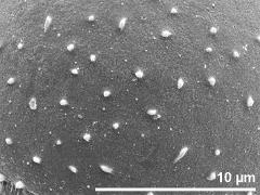 exine surface