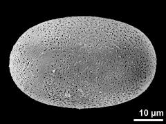 polar proximal view