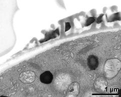 pollen wall at transition of aperture and interapertural area