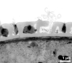 interapertural area of pollen wall