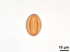 equatorial view,acetolyzed pollen