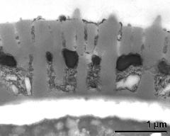 interapertural area of pollen wall