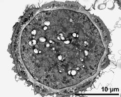 pollen grain in cross section