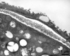 apertural area of pollen wall