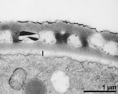 interapertural area of pollen wall