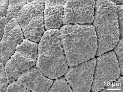 tetrads (forming massula)