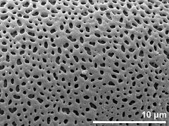 exine surface