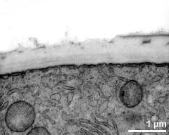 apertural area of pollen wall