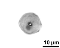 generative cell (asterisk) and vegetative nucleus