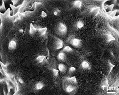 aperture of dry pollen grain