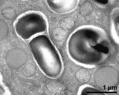 cytoplasm with starch, lipids, mitochondria