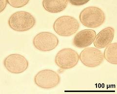 pollen grains in overview